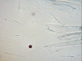 Vorschaubild der Version vom 13. Januar 2012, 23:41 Uhr